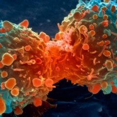Likvidace živých nádorových buněk plazmou